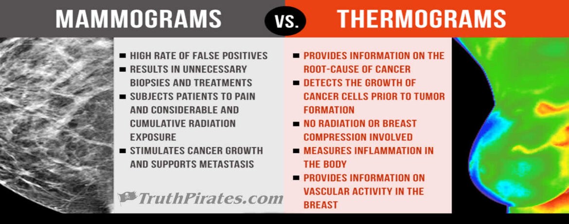 thermography vs mammography